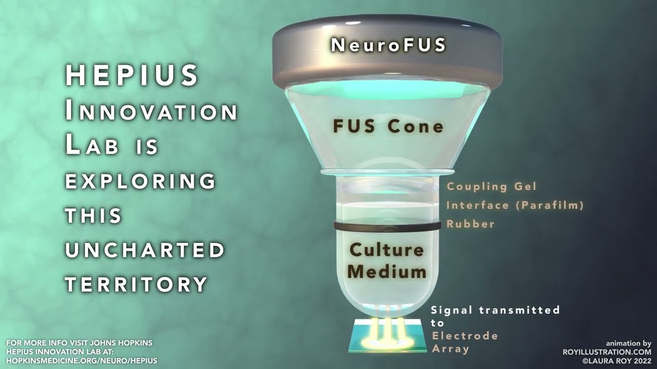 In Vitro Focused Ultrasound (FUS) Micro-Analysis