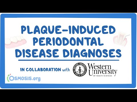 Endodontic Diagnosis in Collaboration w Western University