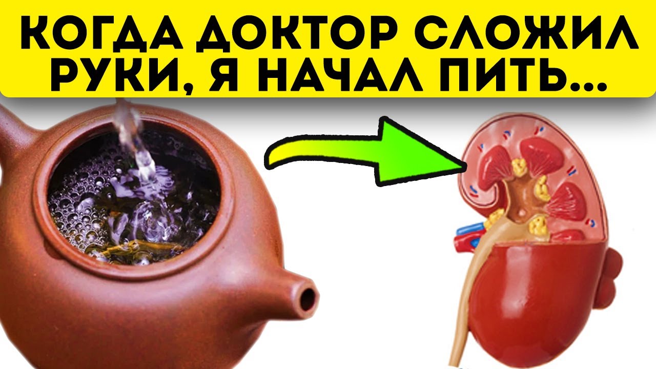 Что делать, если медицина бессильна Для лечения почек я начал заваривать обычную...