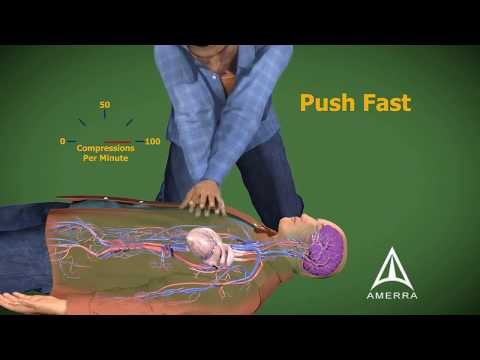 CPR cardiopulmonary resuscitation - 3D animation Video
