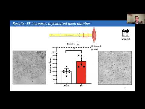 AAHS/ASPN Combined CME Webinar: Electrical Stimulation and Nerve Wrapping in Nerve Injuries