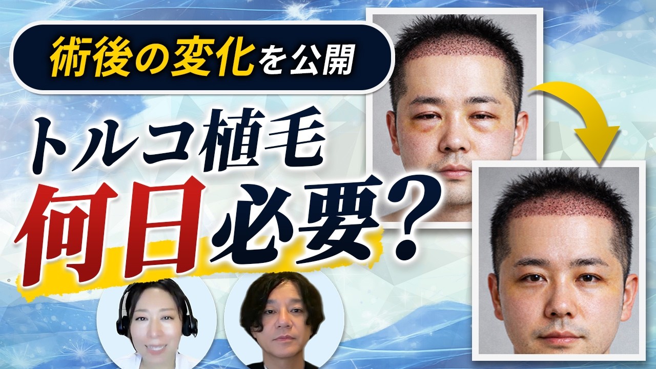 会社復帰はいつから可能？症例写真で見るトルコ植毛 術後1〜14日の経過