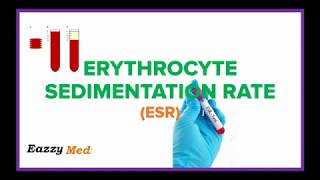 Erythrocyte Sedimentation Rate (ESR) Made Simple