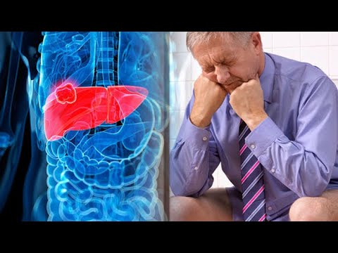 Nëse mëlçia juaj nuk funksionon mirë, ju dërgon këto SINJALE paralajmëruese që mund të jenë fatale…