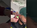 How We Make Custom Earplugs