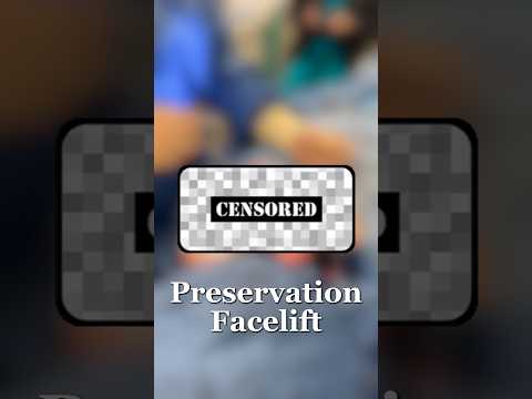 Video Placeholder