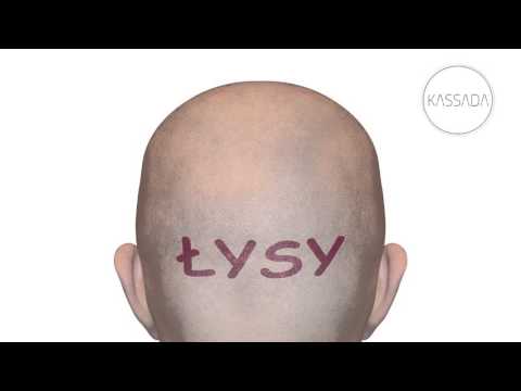 KASSADA - Łysy  (Official Audio)