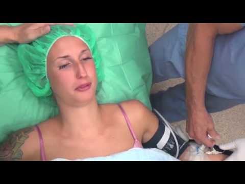 Ci sono calli sulle articolazioni Terminale nervoso nei sintomi colonna cervicale e trattamento