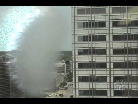 Migraine Visual Aura - Office