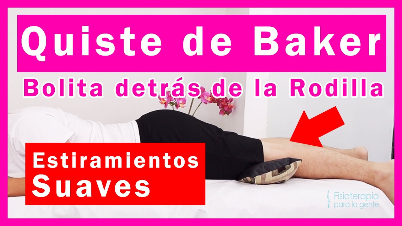 Quiste de Baker, 😱 DEBES SABER ESTO, Estiramientos!🤩