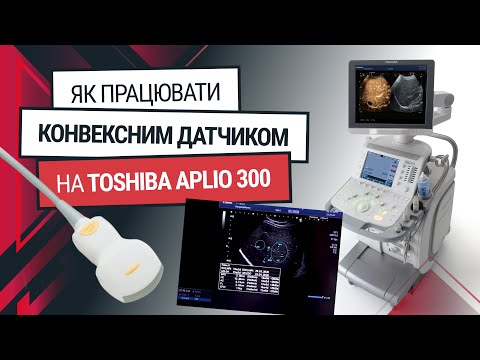 Конвексний датчик до Toshiba Aplio 300 – навчання та функції - Статті RH