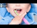 Is spacing between milk teeth normal? - Dr. Srivats Bharadwaj