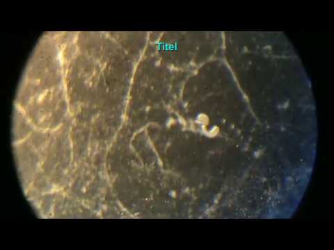 Zerkarien aus Lymnaea Schnecken