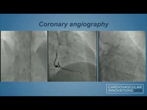 CVI 2019_Thursday, 7/18_ Coronary Challenging Case Competition Semifinals_George Shenoda