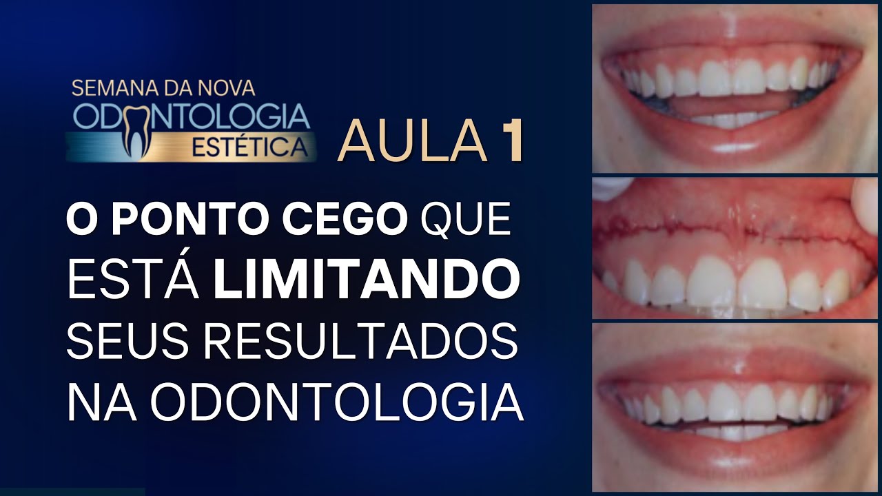 AULA 1 | O Ponto Cego Que Está Limitando Seus Resultados na Odontologia