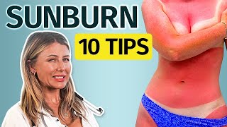 Top 10 Tips to Heal Fast from Sunburn