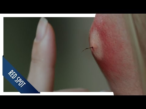 Historias de miedo para contar en las oscuridad | Clip #3 Red Spot | Subtitulado HD