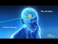 Proton Therapy vs. Conventional Radiation