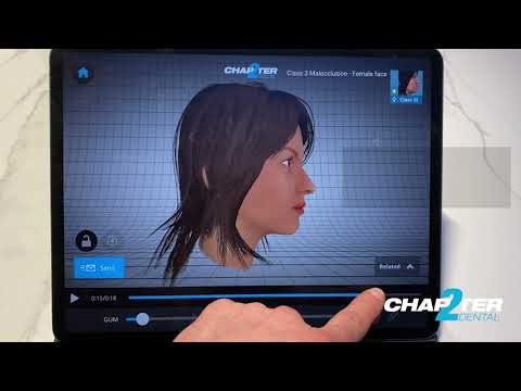 Chapter2Next video thumbnail