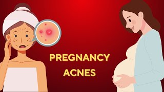 Pregnancy Acne: Causes, Effects, and Remedies!