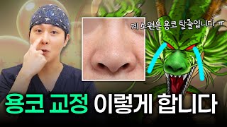 랩틸리언 인상? 용코 교정 성형수술로 해결!