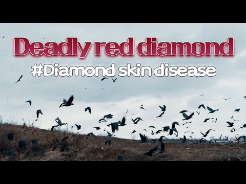, title : '#1 Deadly red diamond  | Diamond skin disease | VAC과사전'