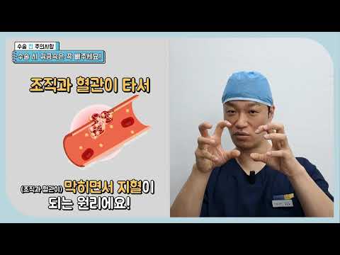 수술 전 주의사항 - 귀금속편