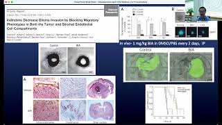 Phosphorex Webinar: Nanoparticle Formulation Enables Systemic Delivery of a Ther Agent to Treat GBM