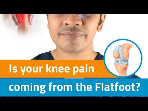 Knee pain due to Flatfoot ?