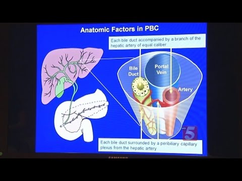 New Hope For PBC Liver Disease