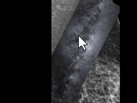 Via lactea de Tabar na Mamografia