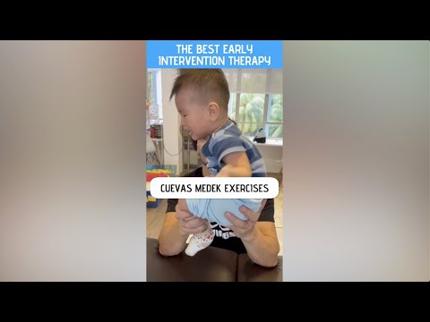 𝐁𝐄𝐒𝐓 𝐄𝐀𝐑𝐋𝐘 𝐈𝐍𝐓𝐄𝐑𝐕𝐄𝐍𝐓𝐈𝐎𝐍 𝐓𝐇𝐄𝐑𝐀𝐏𝐘:  𝐂𝐮𝐞𝐯𝐚𝐬 𝐌𝐞𝐝𝐞𝐤 𝐄𝐱𝐞𝐫𝐜𝐢𝐬𝐞𝐬 🦋❤️🦋❤️