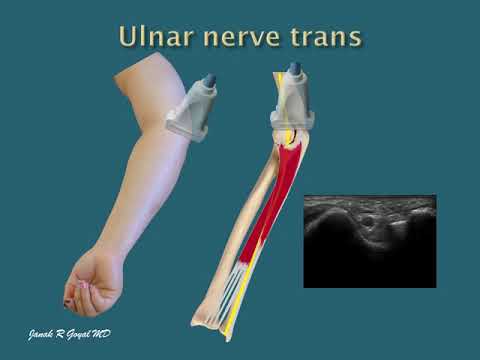 Scanning techniques and sonoanatomy