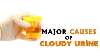 8 Major Causes of Cloudy Urine