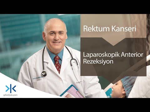 Laparoskopik Anterior Rezeksiyon - Rektum Kanseri
