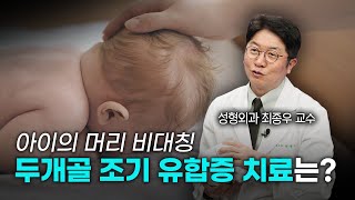 두개골 조기 유합증 치료는? 미리보기