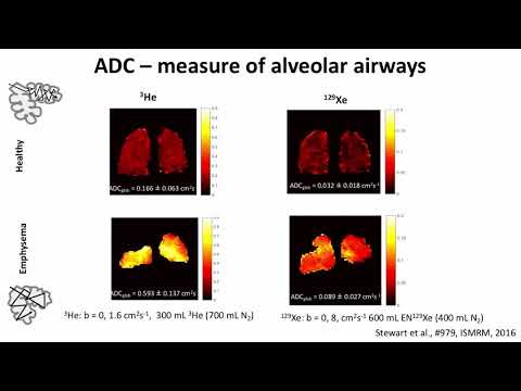 ISMRM MR Academy - Methods and Applications of Hyperpolarized 129Xe