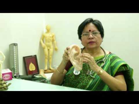 Dr. Rashmi Jha - Acupuncture Video