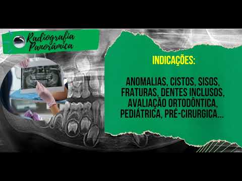 Radiografia Panorâmica