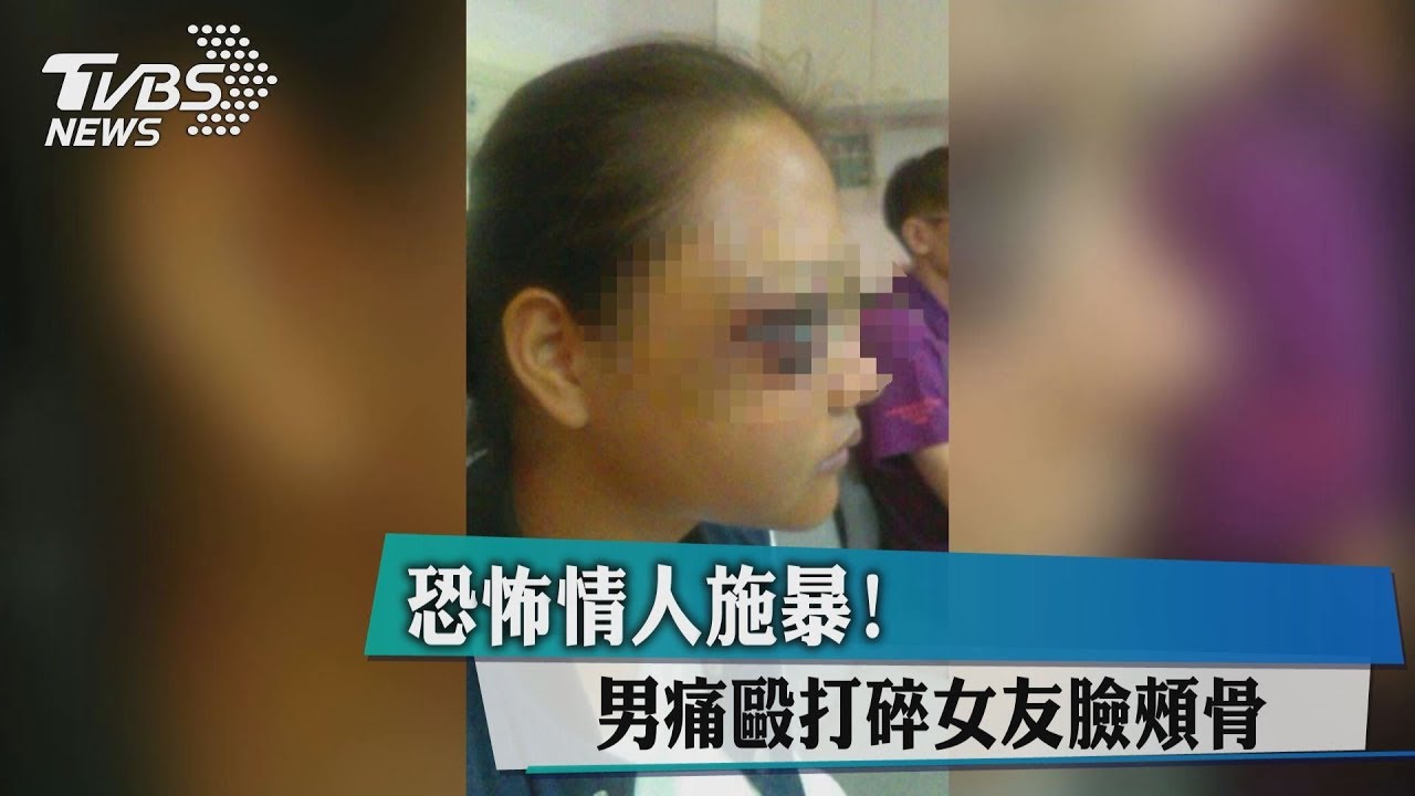 恐怖情人施暴！　男痛毆打碎女友臉頰骨