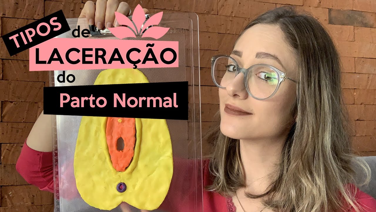 Tipos de laceração do parto normal