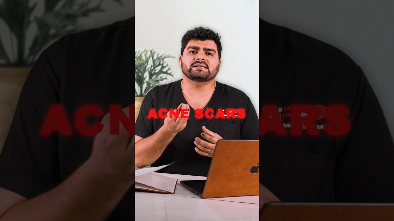 How to Tackle Acne Scars?? | Clear Skin Pune