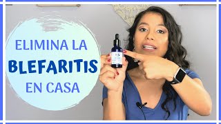 BLEFARITIS TRATAMIENTO CASERO - La Forma Más Efectiva