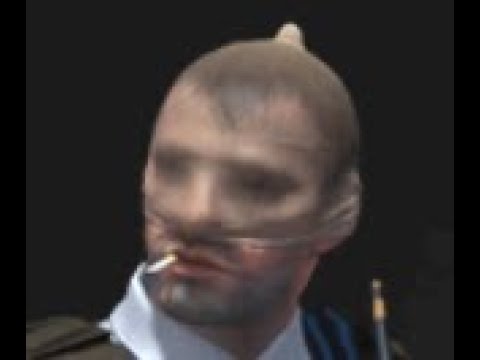 gasze ci peta na czole