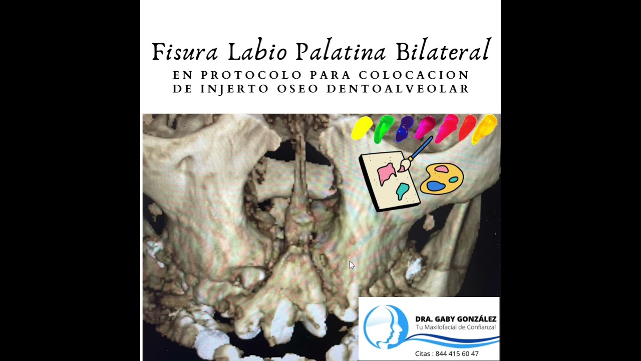 Laura Gabriela González Valdéz-62