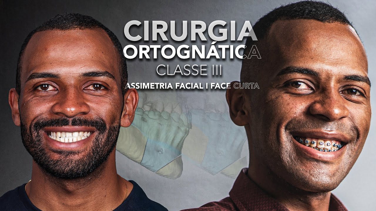 João Pedro Paulino Mazzon-80