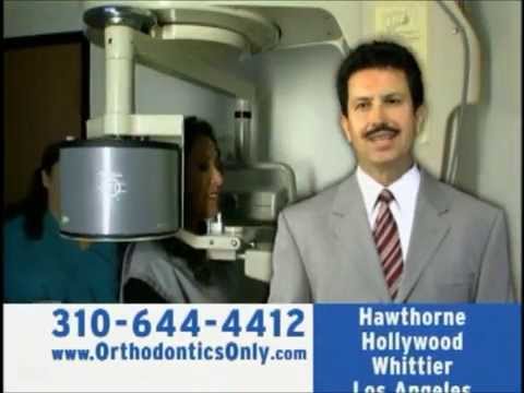 braces before and after in Hawthorne California