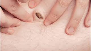 Belly Button Cleaning - Male version