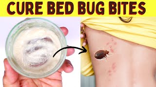 How to get rid of bed bug bites fast overnight and stop from itching while sleeping