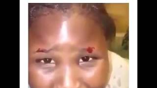 I think it was a bite bug